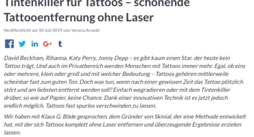 schonende Tattooentfernung ohne Laser