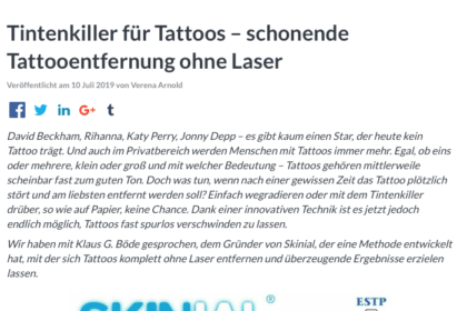 schonende Tattooentfernung ohne Laser