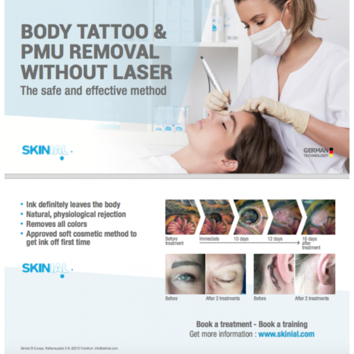 100 × Flyer (Client)